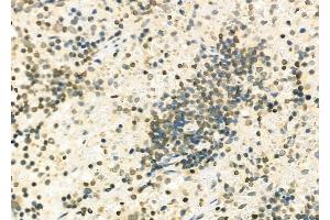 ABIN6263652 and ABIN6279502 at 1/100 staining Rat spleen tissue by IHC-P. (NKX6-2 anticorps  (Internal Region))