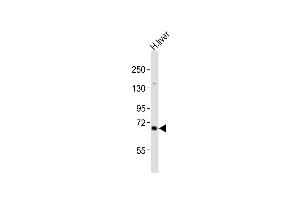 Anti-IDUA Antibody (Center)at 1:2000 dilution + human liver lysates Lysates/proteins at 20 μg per lane.