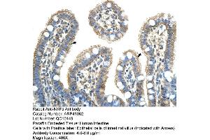 Rabbit Anti-NXF5 Antibody  Paraffin Embedded Tissue: Human Intestine Cellular Data: Epithelial cells of intestinal villas Antibody Concentration: 4. (NXF5 anticorps  (Middle Region))