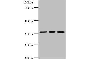 Western blot All lanes: Glutaredoxin-3 antibody at 10 μg/mL Lane 1: Rat brain tissue Lane 2: HepG2 whole cell lysate Lane 3: Hela whole cell lysate Secondary Goat polyclonal to rabbit IgG at 1/10000 dilution Predicted band size: 37 kDa Observed band size: 37 kDa (GLRX3 anticorps  (AA 1-335))