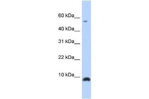 WB Suggested Anti-CXCL6 Antibody Titration: 0. (CXCL6 anticorps  (Middle Region))