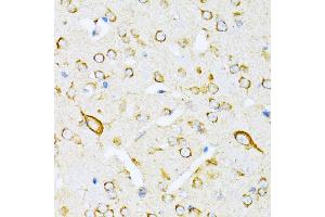 Immunohistochemistry of paraffin-embedded mouse brain using VARS antibody (ABIN1683239, ABIN3018665, ABIN3018666 and ABIN6220533) at dilution of 1:100 (40x lens). (VARS anticorps  (AA 1-280))