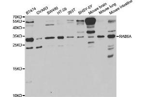 Western blot analysis of extracts of various cell lines, using RAB6A antibody (ABIN5973269) at 1/1000 dilution. (RAB6A anticorps)