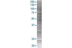 HSPB8 transfected lysate.