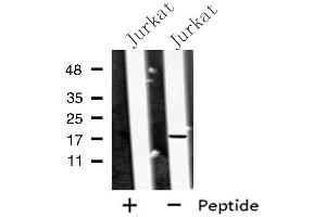 Western blot analysis of MED9 using Jurkat whole cell lysates (MED9 anticorps  (Internal Region))