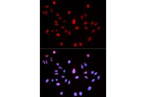 Immunofluorescence (IF) image for anti-Ataxia Telangiectasia Mutated (ATM) (pSer1981) antibody (ABIN1869997) (ATM anticorps  (pSer1981))