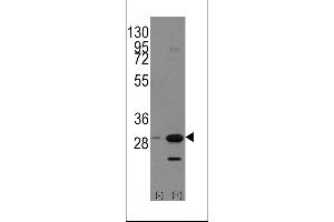 Western blot analysis of PHB1 using rabbit polyclonal PHB1 Antibody (Human C-term) using 293 cell lysates (2 ug/lane) either nontransfected (Lane 1) or transiently transfected with the PHB1 gene (Lane 2). (Prohibitin anticorps  (C-Term))