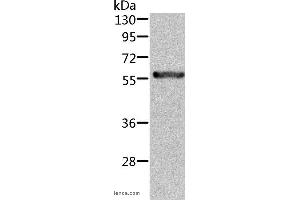 Western blot analysis of Rat kidney tissue, using ALDH6A1 Polyclonal Antibody at dilution of 1:450 (ALDH6A1 anticorps)