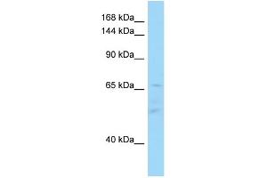 WB Suggested Anti-IL16 Antibody Titration: 1. (IL16 anticorps  (C-Term))