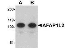 Western blot analysis of AFAP1L2 in mouse liver tissue lysate with AP30026PU-N AFAP1L2 antibody at (A) 1 and (B) 2 μg/ml. (AFAP1L2 anticorps  (C-Term))