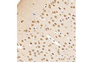Immunohistochemistry of paraffin embedded mouse brain using NSFL1C (ABIN7074865) at dilution of 1:700 (400x lens)