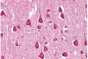 Anti-SLC18A1 / VMAT1 antibody IHC staining of human brain-cortex. (SLC18A1 anticorps  (C-Term))