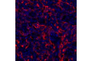 anti-Hepatitis A Virus Cellular Receptor 2 (TIM 3) (AA 22-201) antibody