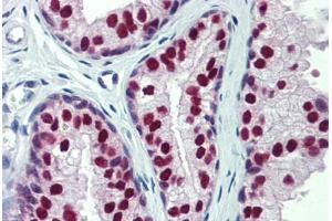 Human Prostate: Formalin-Fixed, Paraffin-Embedded (FFPE)