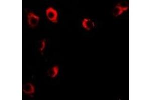 Immunofluorescent analysis of VILIP-1 staining in U2OS cells.