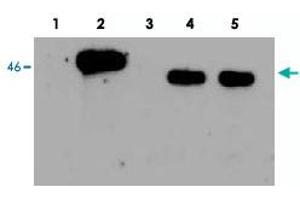 Western Blot analysis of human EGLN1, using EGLN1 polyclonal antibody . (EGLN1 anticorps)