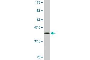 Western Blot detection against Immunogen (39. (IFITM1 anticorps  (AA 1-125))