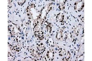 Image no. 4 for anti-RalA Binding Protein 1 (RALBP1) antibody (ABIN1500585)