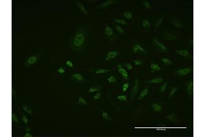 Immunofluorescence of monoclonal antibody to TFAP2A on HeLa cell.