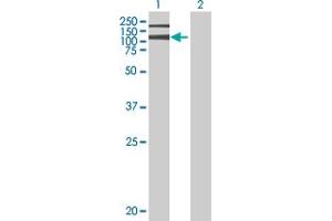Lane 1: ADAR transfected lysate ( 136 KDa) Lane 2: Non-transfected lysate.
