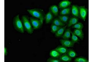 Immunofluorescent analysis of A549 cells using ABIN7168341 at dilution of 1:100 and Alexa Fluor 488-congugated AffiniPure Goat Anti-Rabbit IgG(H+L)
