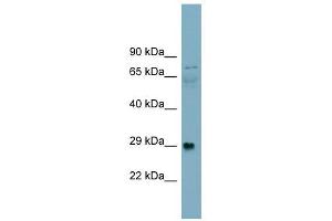 DAG1 antibody used at 1 ug/ml to detect target protein.