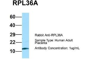 Host: Rabbit  Target Name: RPL36A  Sample Tissue: Human Adult Placenta  Antibody Dilution: 1.