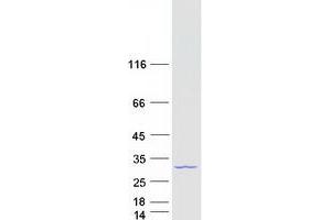 Validation with Western Blot