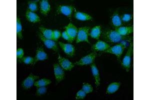 IF analysis of TAGLN/Transgelin using anti-TAGLN/Transgelin antibody (ABIN7600099).