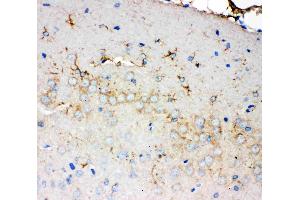Anti-PMP70 antibody, IHC(P): Rat Brain Tissue (CX3CL1 anticorps  (C-Term))