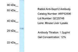 Western Blotting (WB) image for anti-Septin 12 (Sep12) (Middle Region) antibody (ABIN2785053) (Septin 12 anticorps  (Middle Region))