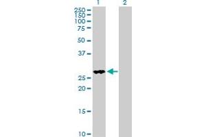 Western Blot analysis of FHL2 expression in transfected 293T cell line by FHL2 MaxPab polyclonal antibody. (FHL2 anticorps  (AA 1-279))