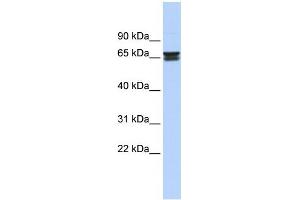 WB Suggested Anti-ZNF614 Antibody Titration:  0. (ZNF614 anticorps  (Middle Region))