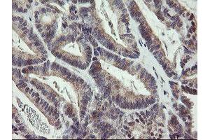 Image no. 2 for anti-Zinc Finger, BED-Type Containing 1 (ZBED1) antibody (ABIN1501793)