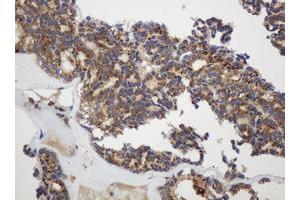 Image no. 1 for anti-Glyceraldehyde-3-Phosphate Dehydrogenase, Spermatogenic (GAPDHS) antibody (ABIN1498375) (GAPDHS anticorps)