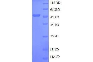 30S Ribosomal Protein S3 (AA 2-233), (full length) protein (GST tag)