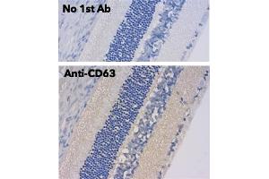 Immunohistochemistry (IHC) image for anti-CD63 (CD63) (AA 120-175) antibody (ABIN1440014)