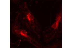 Immunocytochemistry (ICC) image for anti-VAMP (Vesicle-Associated Membrane Protein)-Associated Protein A, 33kDa (VAPA) (AA 1-223) antibody (ABIN1742504)