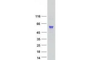 Validation with Western Blot