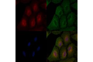 ABIN6260836 and ABIN6266727 staining  cells by IF/ICC. (CIB2 anticorps  (Internal Region))