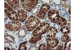 Immunohistochemical staining of paraffin-embedded Human Kidney tissue using anti-GRHPR mouse monoclonal antibody. (GRHPR anticorps)