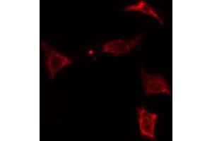 ABIN6274315 staining Hela cells by IF/ICC. (MVK anticorps  (Internal Region))