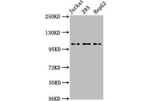 Western Blot Positive WB detected in: Jurkat whole cell lysate, 293 whole cell lysate, HepG2 whole cell lysate All lanes: KIF5B antibody at 3. (KIF5B anticorps  (AA 338-514))