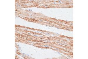 Immunohistochemistry of paraffin-embedded rat heart using GRK5 antibody (ABIN1680115, ABIN3018251, ABIN3018252 and ABIN6220413) at dilution of 1:100 (40x lens). (GRK5 anticorps  (AA 371-590))