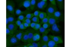 IF analysis of Ankyrin Erythroid/ANK/ANK1 using anti-Ankyrin Erythroid/ANK/ANK1 antibody (ABIN7599959).