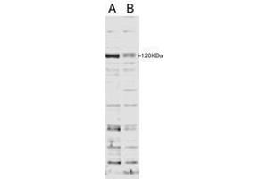 Image no. 1 for anti-SECIS Binding Protein 2 (SECISBP2) (AA 545-557) antibody (ABIN293116) (SECISBP2 anticorps  (AA 545-557))