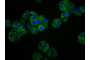 Immunofluorescence staining of HepG2 cells with ABIN7157534 at 1:100, counter-stained with DAPI. (KIR3DS1 anticorps  (AA 198-335))