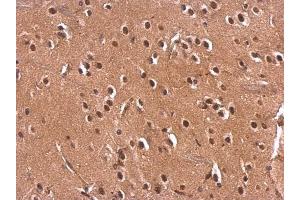 IHC-P Image Monoglyceride lipase antibody detects Monoglyceride lipase protein at nucleus on rat fore brain by immunohistochemical analysis. (MGLL anticorps)