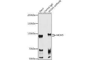 Immunoprecipitation analysis of 300 μg extracts of Raji cells using 3 μg MCM5 antibody (ABIN6132074, ABIN6143644, ABIN6143646 and ABIN6217542).