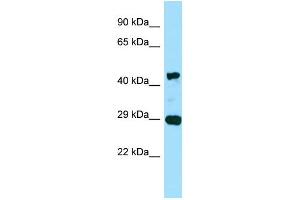 WB Suggested Anti-ACTG2 Antibody Titration: 0. (ACTG2 anticorps  (C-Term))